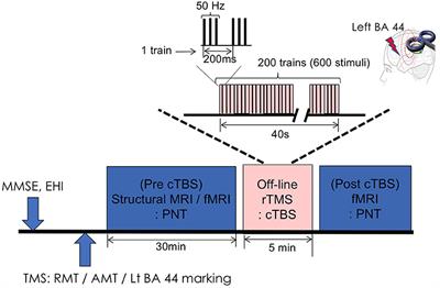 Continuous theta-burst stimulation over the left posterior inferior frontal gyrus induced compensatory plasticity in the language network